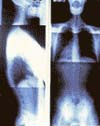 Chriopractic Glencoe MN X-Rays